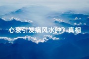 心衰引发痛风水肿？真相揭秘